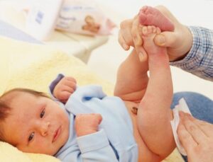 Fimosis En El Bebe Que Hacer Antes De Operar Blog Del Bebe