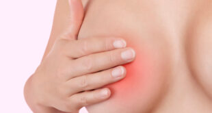 Mastitis en bebés