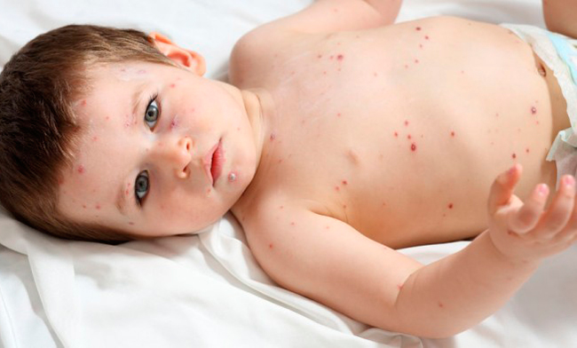 alergias en la piel sintomas