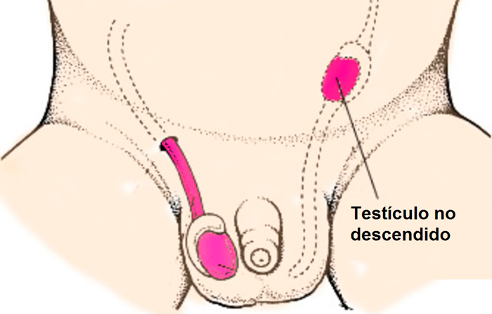 testiculos en ingles | testiculo retractil