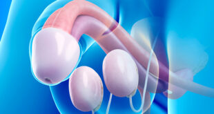 testiculos grandes enfermedad