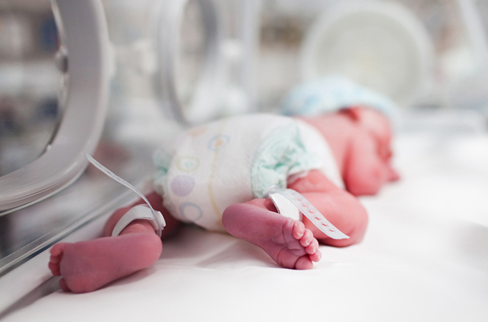 síndrome de Patau embarazo síndrome de Patau embarazo