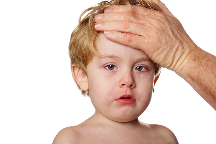 migraña en niños tratamiento