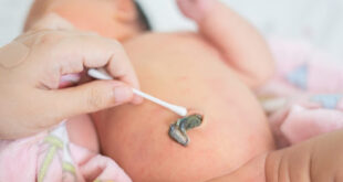 a cuantos dias se cae el cordon umbilical