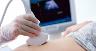 eco doppler ginecologico