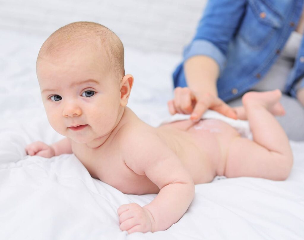 tratamiento piel atopica bebes