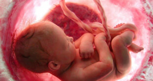 placenta sana embarazo
